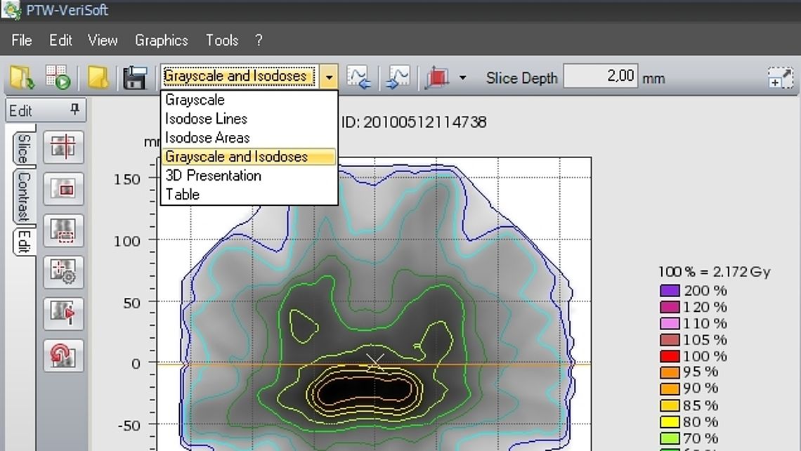 Various dose display options: Grayscale images, isodose contours, dose distribution maps, tables