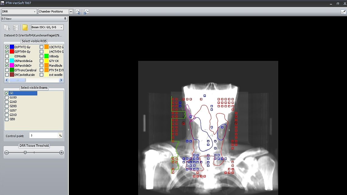 DRR view with superimposed isodose contours and failed points (OCTAVIUS II/4D only)