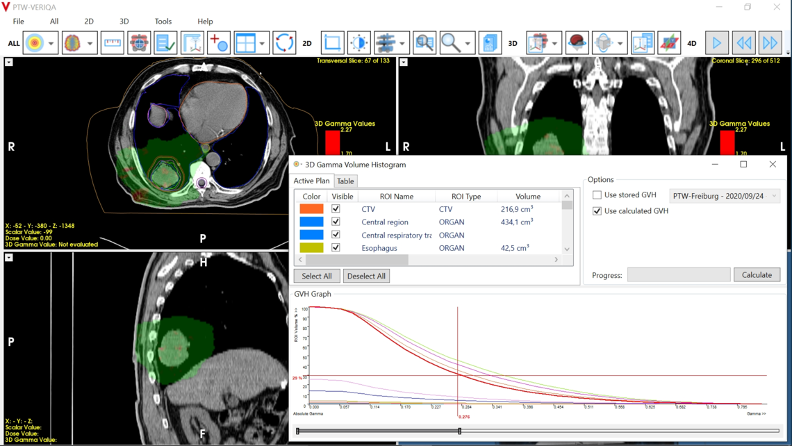 VERIQA visualization tools for plan review: visualization of gamma distribution and gamma-volume-histogram