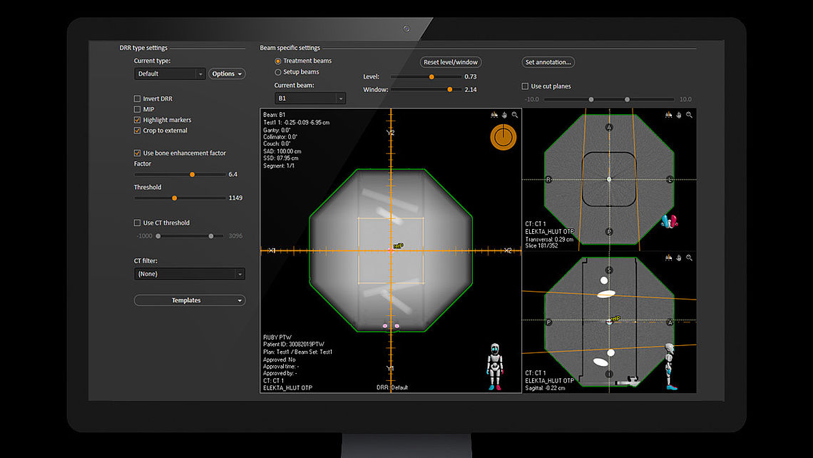 LINAC QA DRR generation using  RayStation treatment planning system