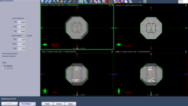 Acquire CBCT (3 minutes)